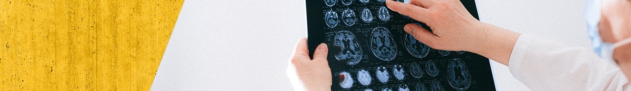 Person looking at X-ray scans of a brain