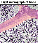 Light micrograph of bone