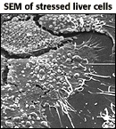 Micrograph of SEM of stressed liver cells 
