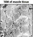 TEM of muscle tissue